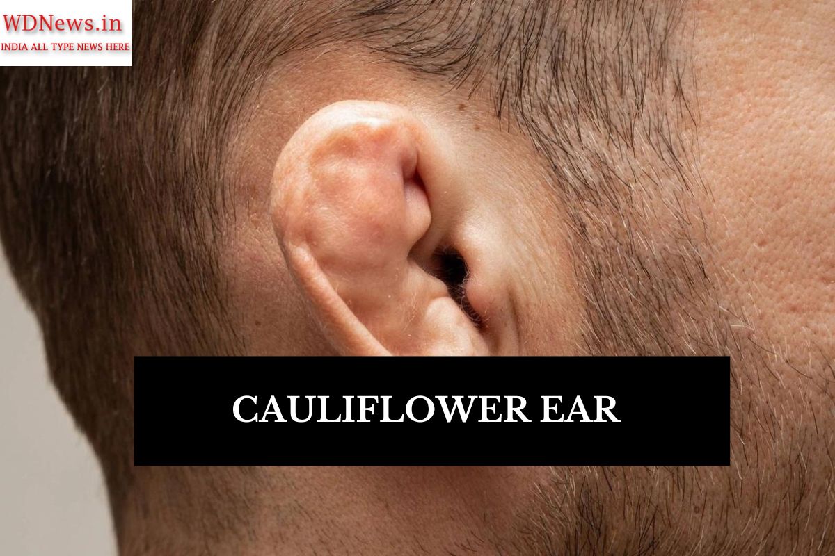 Cauliflower ear